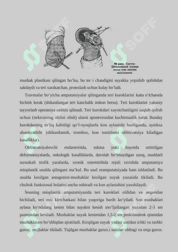 KO‘L-OYOQLAR   AMPUTATSIYASI VA ULARNI PROTEZLASH 8