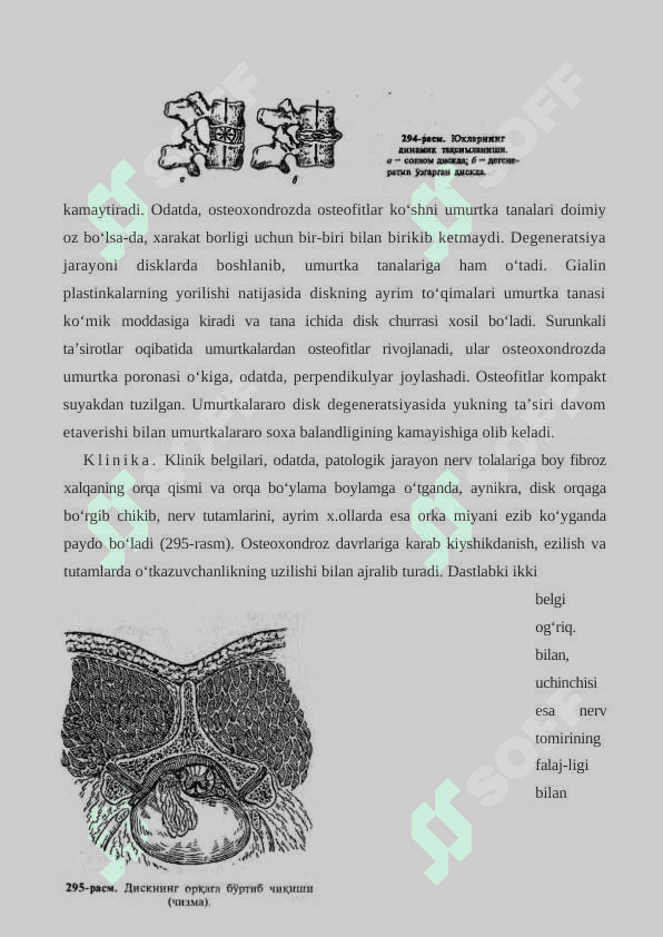 UMURTQA POG‘ONASINING DEGENERATIV KASALLIKLARI 4