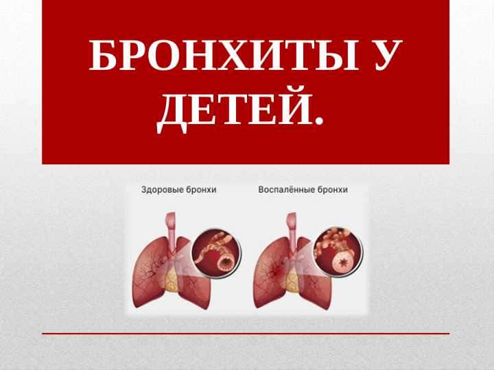 БРОНХИТЫ У ДЕТЕЙ