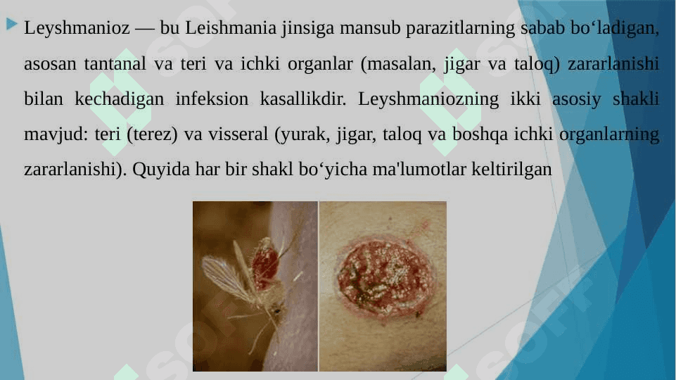 Leyshmanioz teri va visseral shakli. Epidemiologiyasi,patagenezi,klinikasi, laborator diagnostika va davolash 3