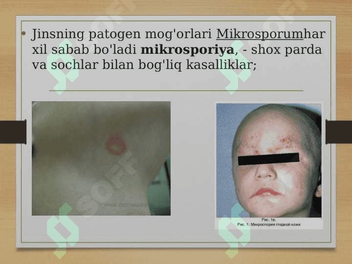Patogen zamburuglar quzg'atadigan kasalliklar pptx 4