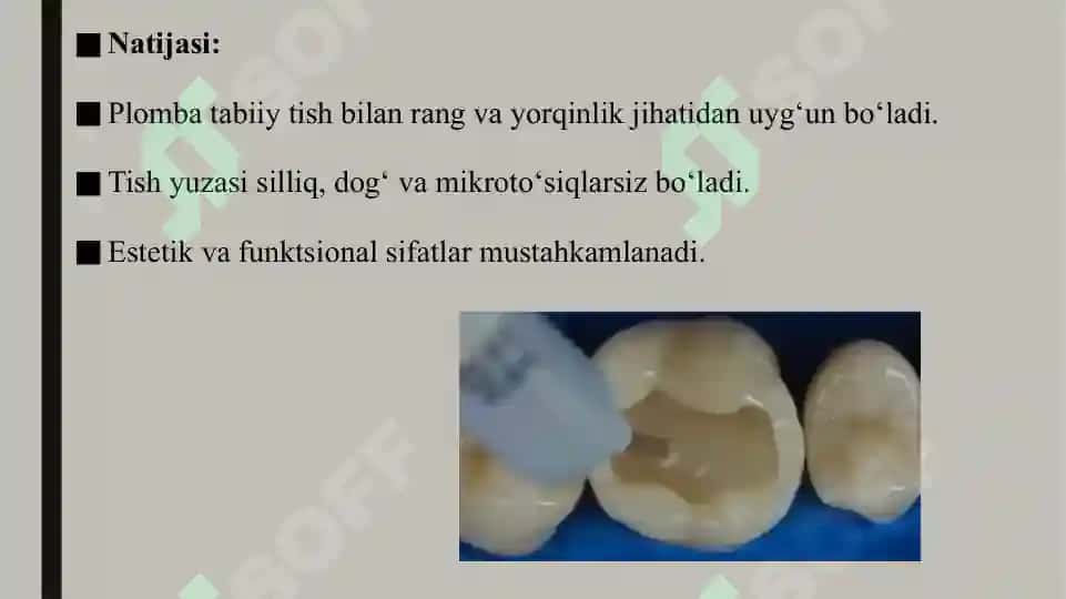 Doimiy plombalarga birlamchi pardoz berish 5