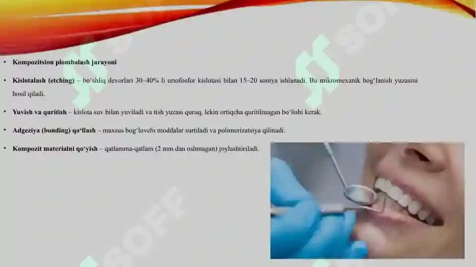 Karioz bo'shliqni kompozitsion plomba ashyosi bilan plombalash 4
