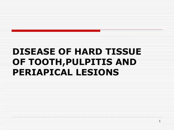 DISEASE OF HARD TISSUE OF TOOTH,PULPITIS AND PERIAPICAL LESIONS