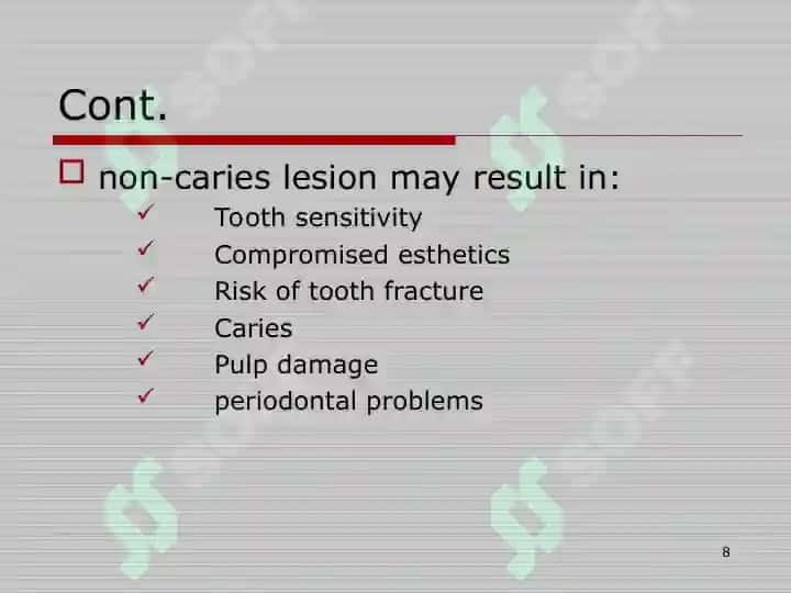DISEASE OF HARD TISSUE OF TOOTH,PULPITIS AND PERIAPICAL LESIONS 8