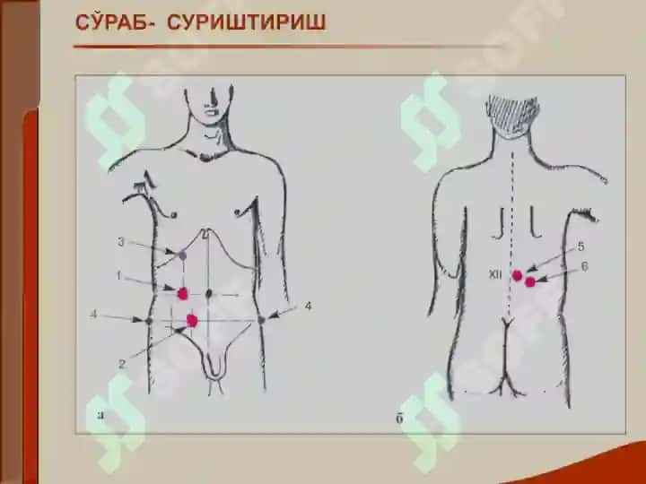 Buyrak kasalligi bilan o'rgangan bemorlarini tekshirish. Asosiy klinik sindromlar. Bujrak etishmovchiligi 6