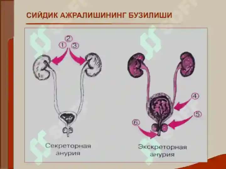 Buyrak kasalligi bilan o'rgangan bemorlarini tekshirish. Asosiy klinik sindromlar. Bujrak etishmovchiligi 8