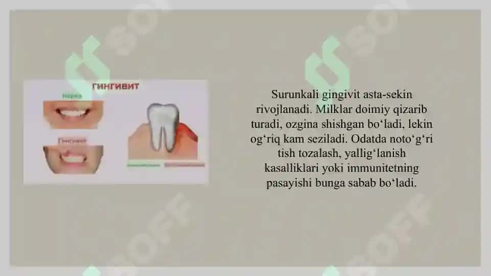 Bolalarda o’tkir va surunkali, atrofik, kataral, va gipertrofik gigngivit. 3