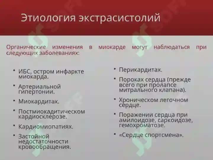 Экстрасистолии 8