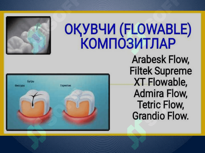 Oquvchan kompozit plomba ashyolari 3
