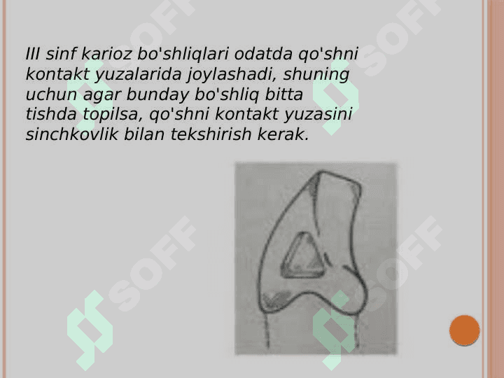III sinf karioz bo'shliqlarini charxlash va plombalash. 3