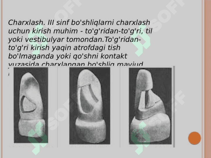 III sinf karioz bo'shliqlarini charxlash va plombalash. 4