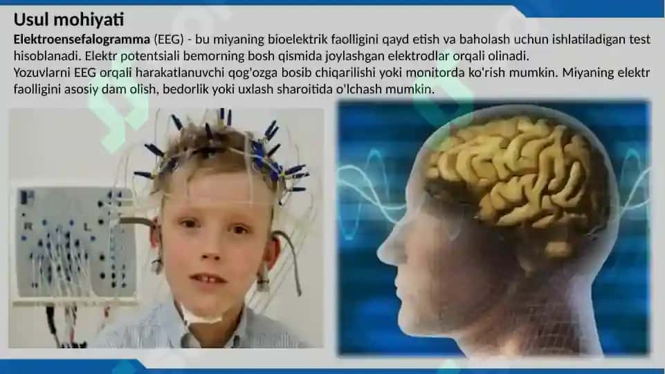 Elektro- Ensefalograf Apparati 4