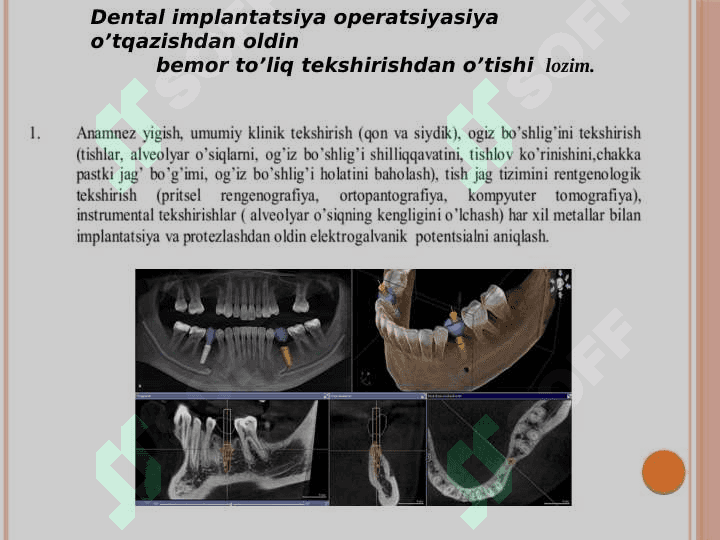 Pastki jag'da dental implantatsiya 2