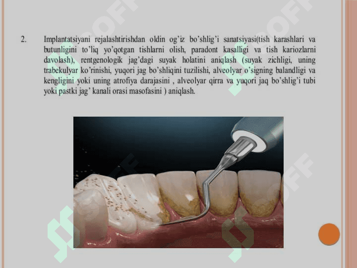 Pastki jag'da dental implantatsiya 3