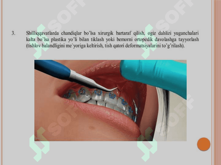 Pastki jag'da dental implantatsiya 4