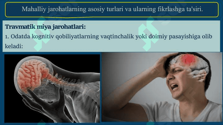 Mahalliy miya jarohatlari jarayonida fikrlashning buzilishi 4