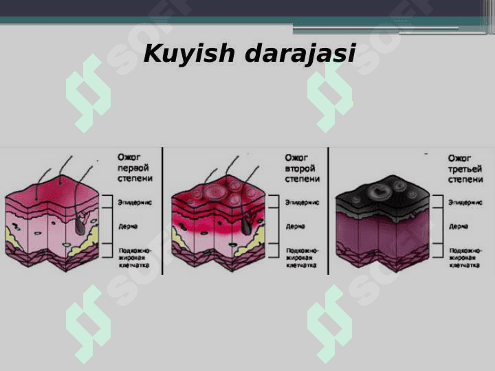 Kuyish kasalligi 8