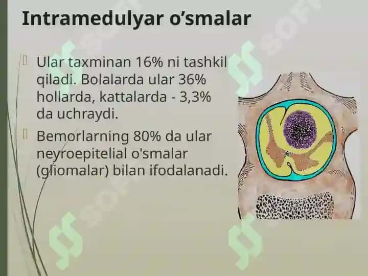 Orqa miya o’smalari 5