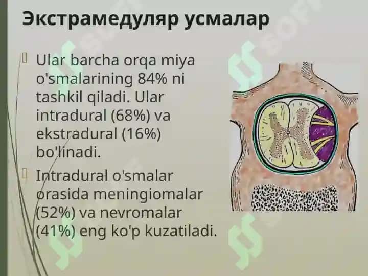 Orqa miya o’smalari 7