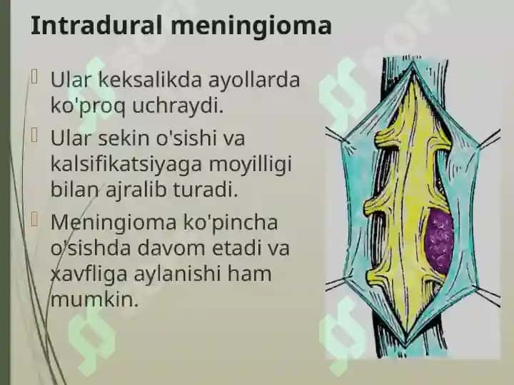 Orqa miya o’smalari 8