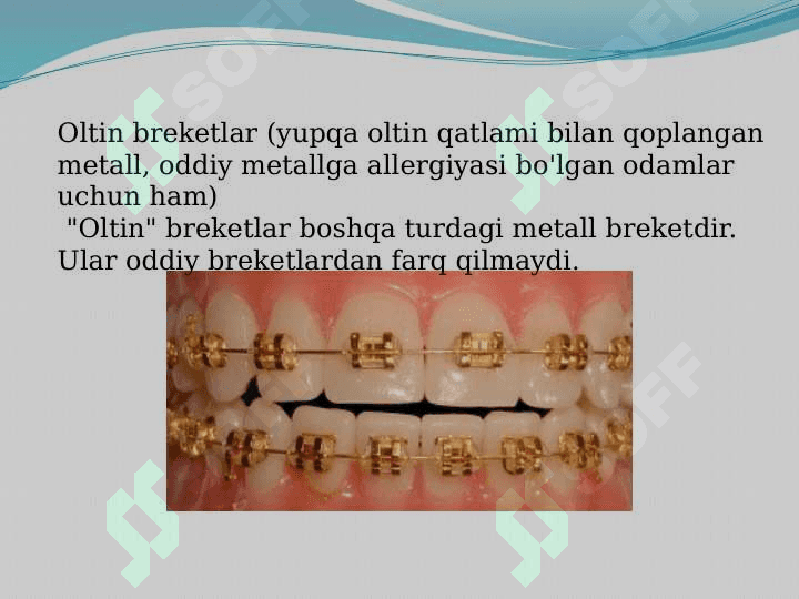 Breketlar 8