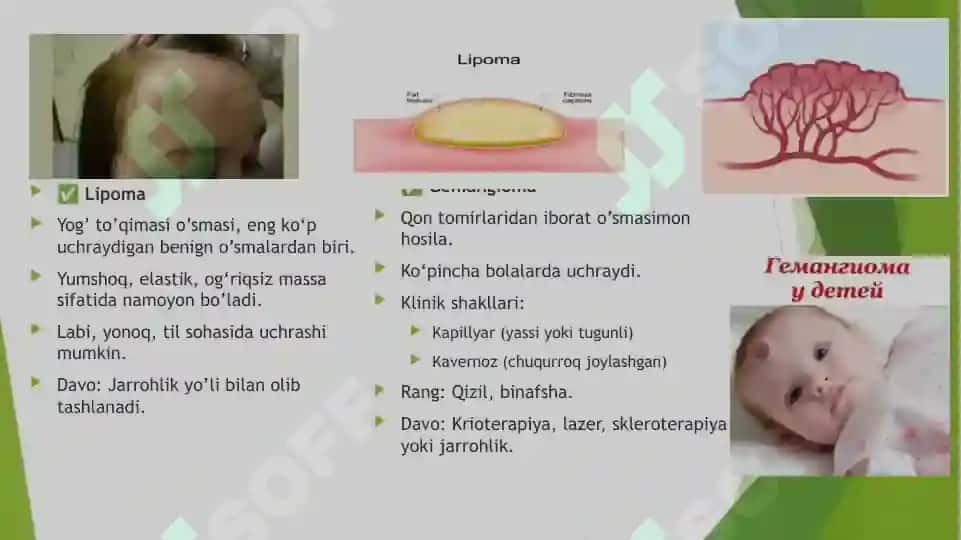 Yuz-jag’ sohasi yumshoq to’qimalari xavfsiz o’smalari va o’smasimon hosilalari(fibroma,fibramatoz,epilus,lipoma,gemangioma,limfangioma) 6