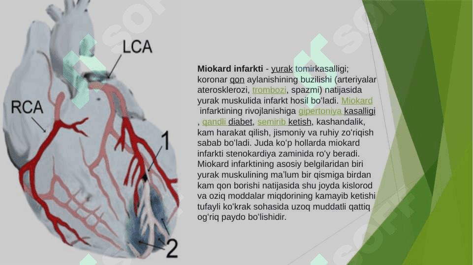 Miokard infarkti 2