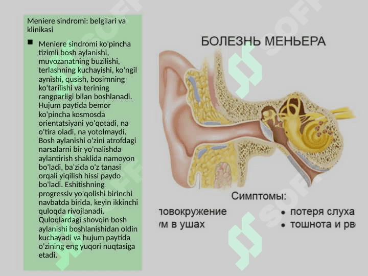 Meniere kasalligin kelib chiqish sabablari 3
