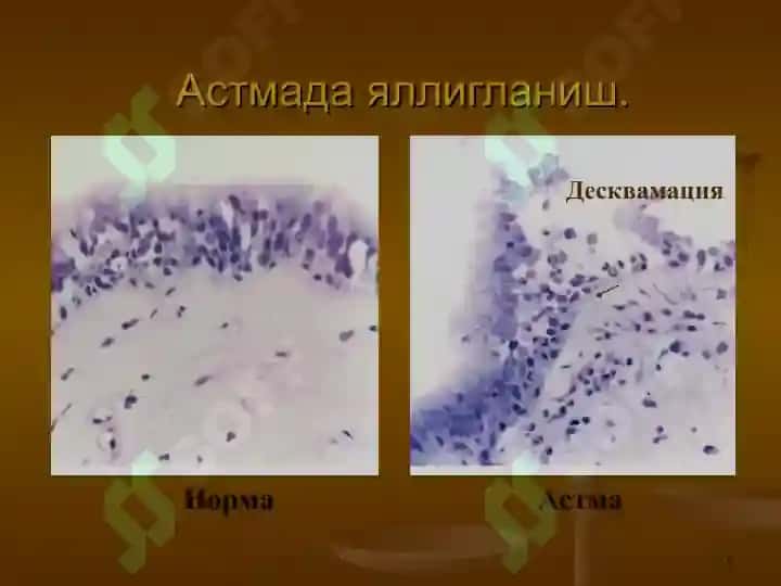 Нафас тизими патофизиологияси 5