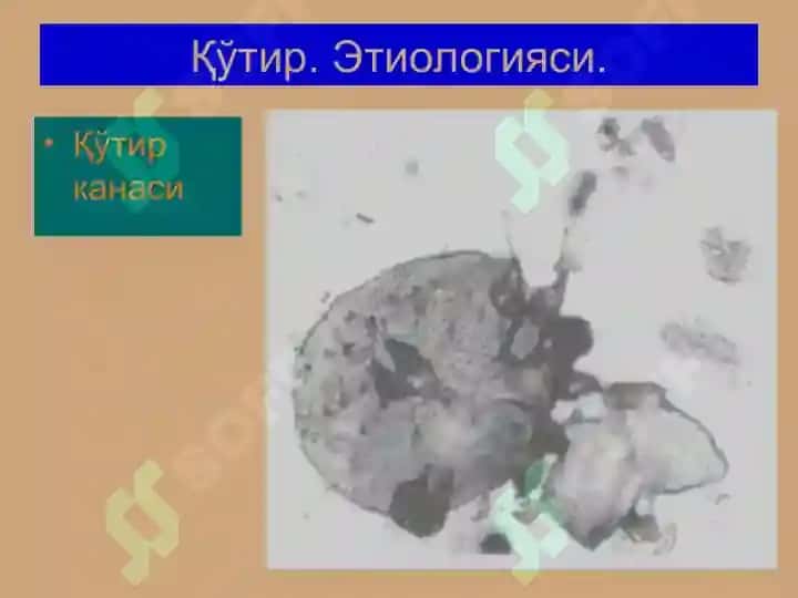 Терининг паразитар касалликлари 4