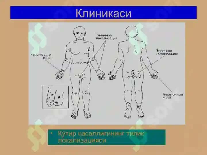 Терининг паразитар касалликлари 7
