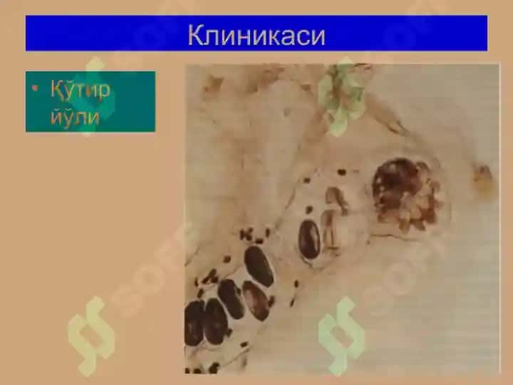 Терининг паразитар касалликлари 8