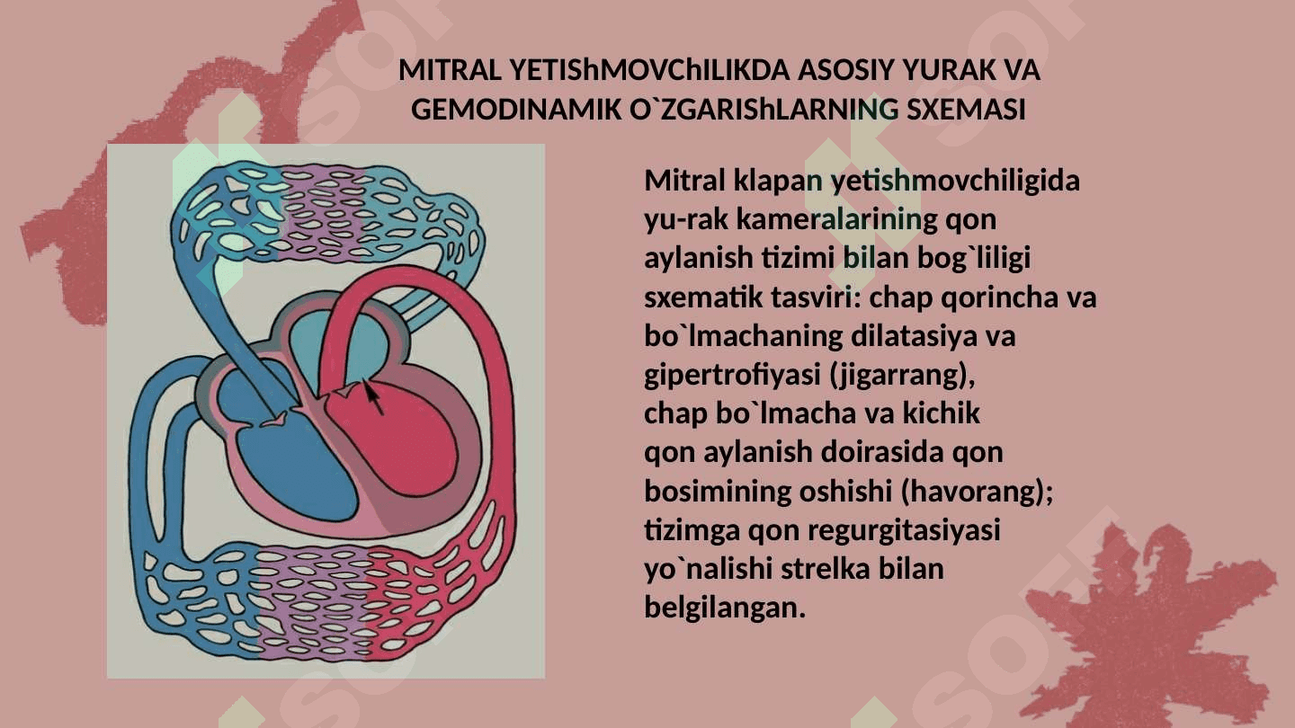 Mitral va Aortal  yurak nuqsonlarining gemodinamikasi 5