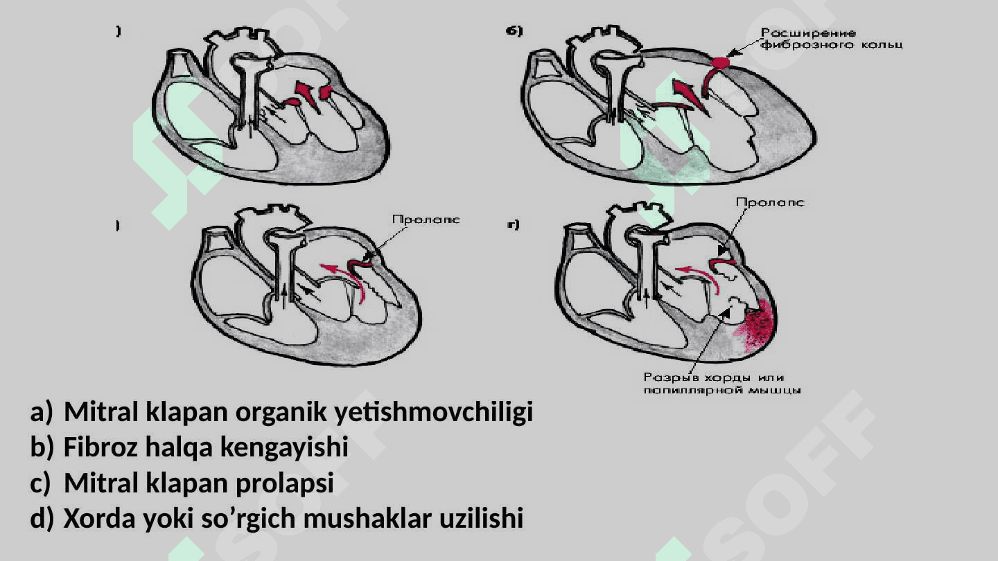 Mitral va Aortal  yurak nuqsonlarining gemodinamikasi 7