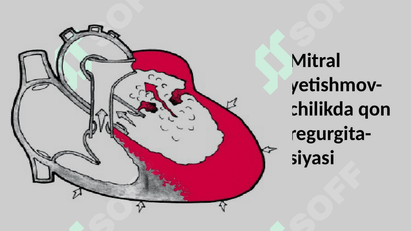 Mitral va Aortal  yurak nuqsonlarining gemodinamikasi 8