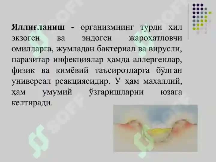Стероид ва ностероид  яллиғланишга қарши дори воситалари.pptx 2
