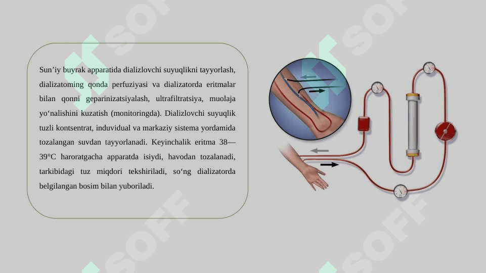DAVOLOVCHI XUSUSIYATGA EGA TIBBIY APPARATURALAR 7