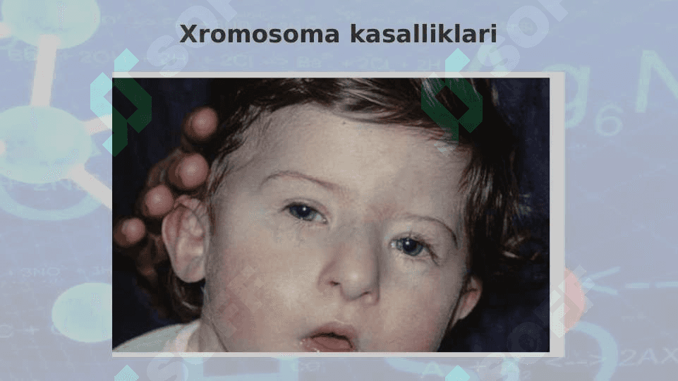 XROMOSOMA KASALLIKLARINING KELIB CHIQISH SABABLARI VA ASORATLARI 24 3