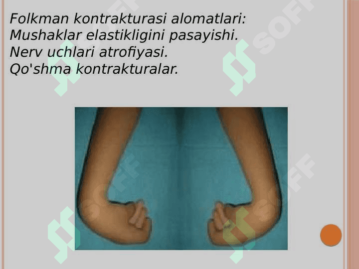 Folkman ishemik kontrukturasi 7
