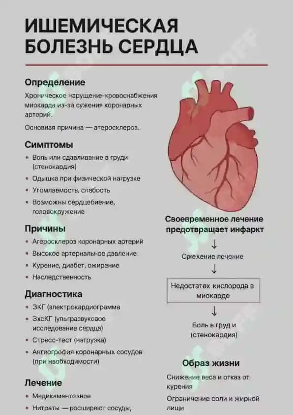 Кардиология: схемы и конспект 2