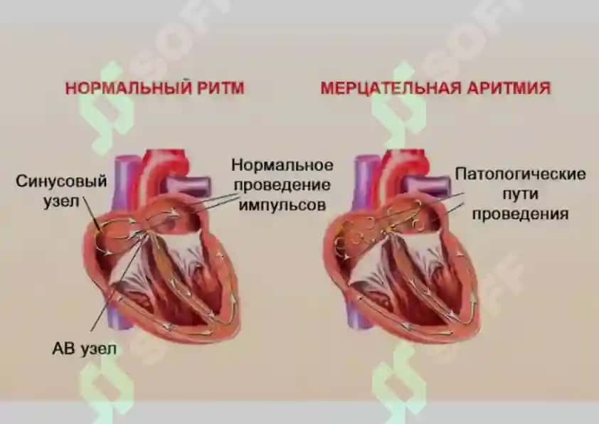 Кардиология: схемы и конспект 4