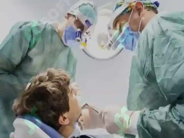 Extractions & Veneers 3