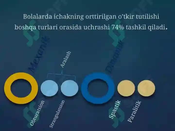 Orttirilgan o’tkir ichak tutilishi 3