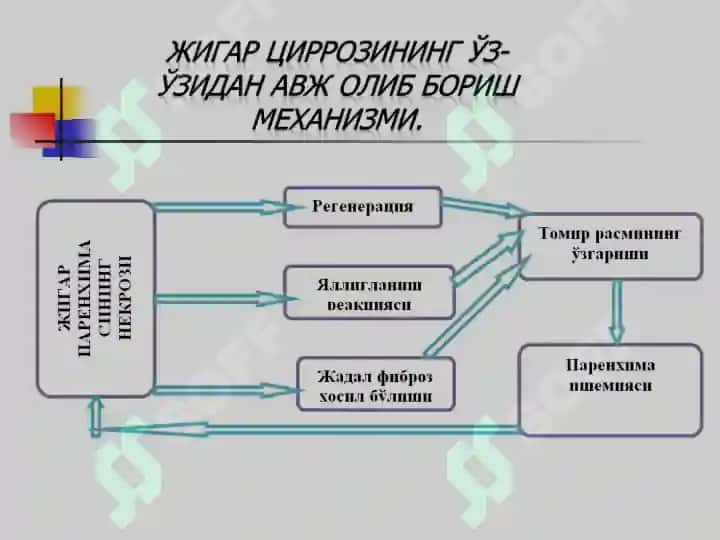 Жигар циррози,JIGAR SIRROZI 5