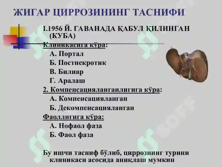 Жигар циррози,JIGAR SIRROZI 6