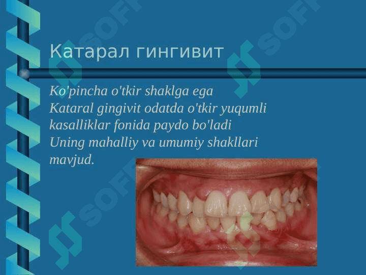 Bolalarda gingivitni 
davolash 4