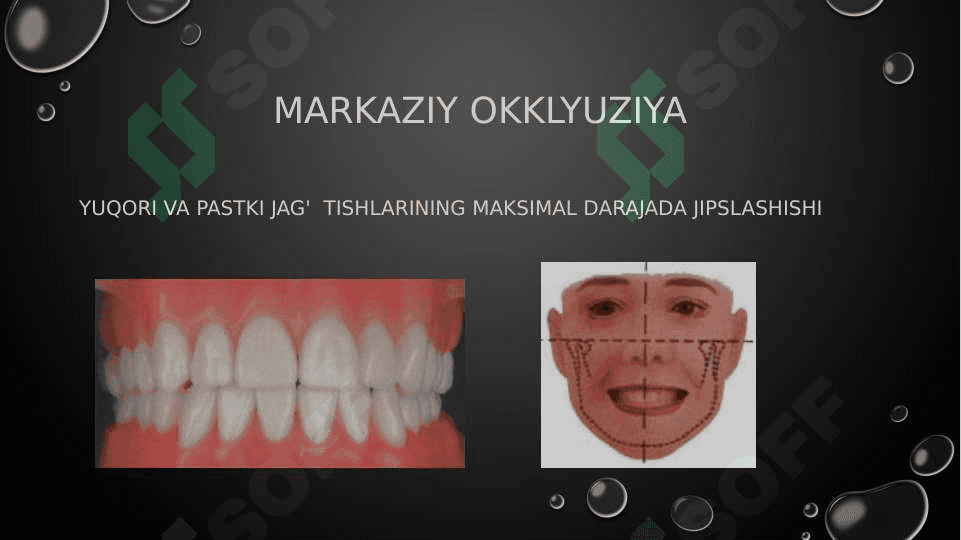 Markaziy okklyuziya 2