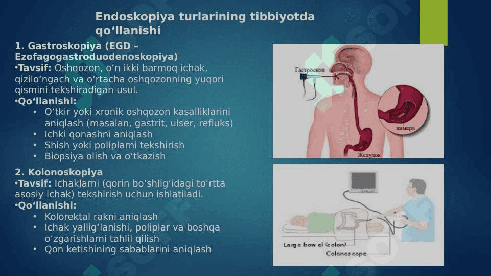 Tibbiyotda endoskopiya usullarning qo’llanishi 4