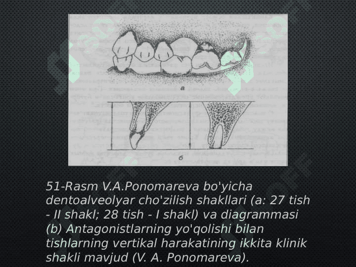 Tish qatori deformatsiyalarini Gavrilov 
va Ponomaryova bo'yicha tasniflari 6